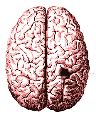 picture showing an ischemic area of the brain caused by a lack of oxygen