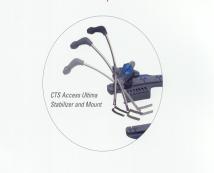picture of device used with minimally invasive surgery