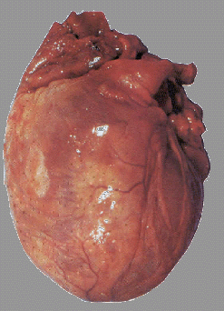 picture of a heart damaged by alcohol