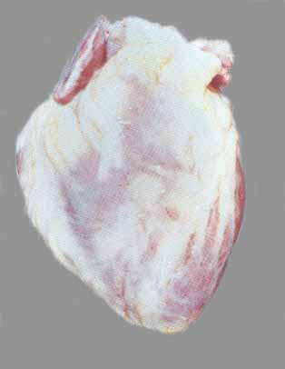 picture of a normal healthy heart